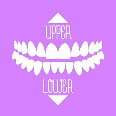 Upper or Lower Jaw Restoration with Dental Implants